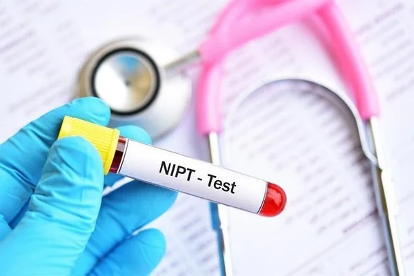 Top 6 đơn vị xét nghiệm NIPT Bình Định chất lượng nhất