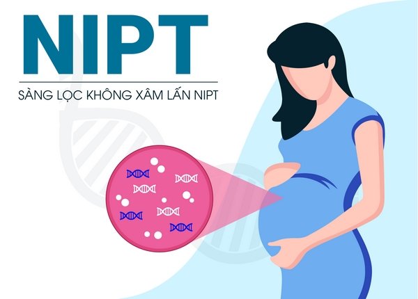 Top 4 đơn vị xét nghiệm NIPT Lào Cai chuyên nghiệp